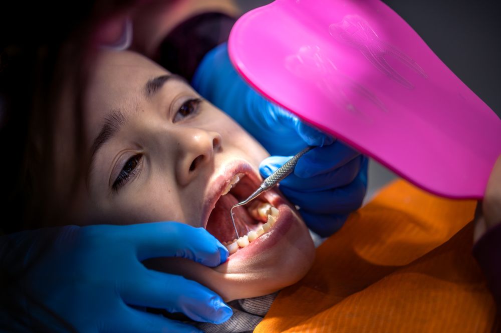 dental sealants for children near you protect kids teeth