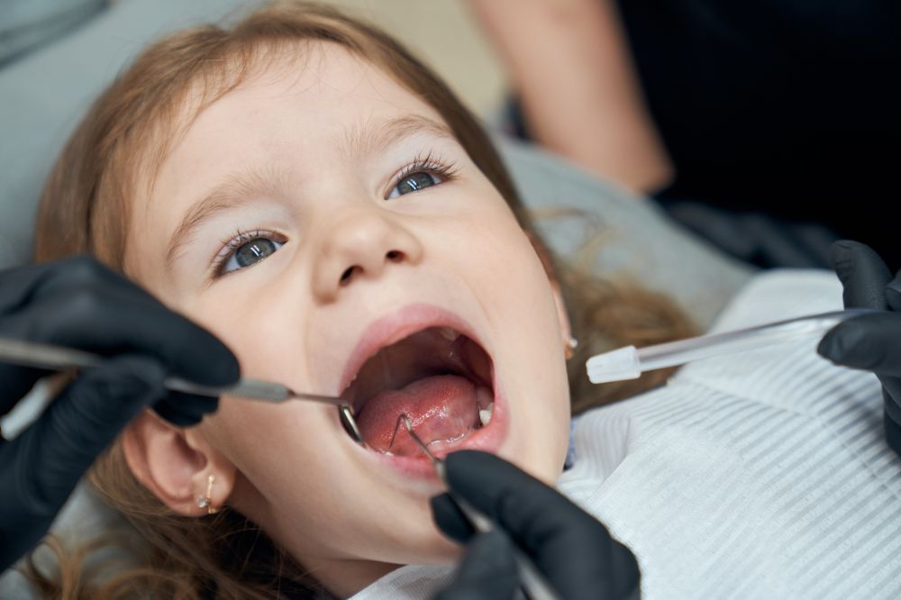5 common myths about kids dental sealants busted