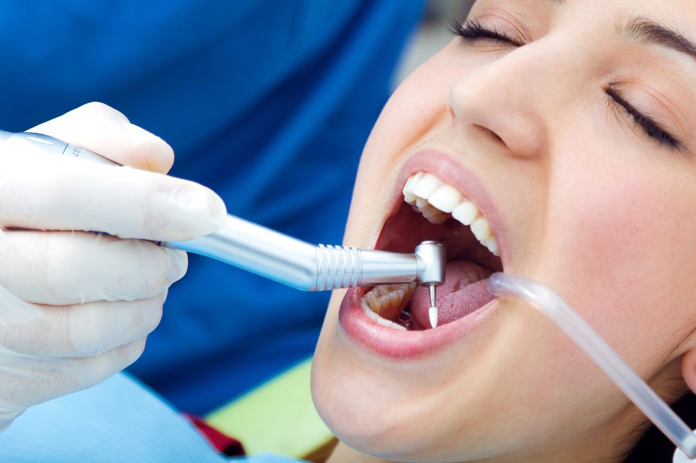 new dental sealant technology 2026 superior